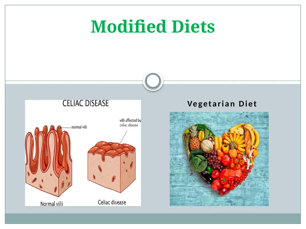 Modified Diets Vegetarian Diet Test Your Knowledge - slide 1 of 17
