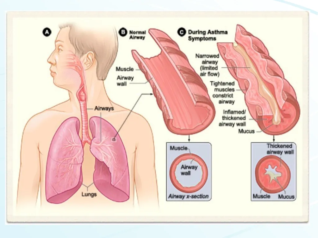 Respiratory System Pharmacology Akinluyi E.T. - slide 21 of 43