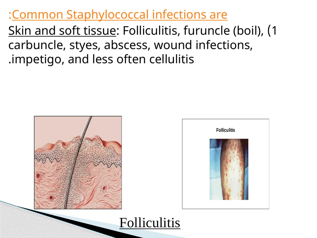 STAPHYLOCOCCUS Staphylococci are : -Gram positive - slide 19 of 42